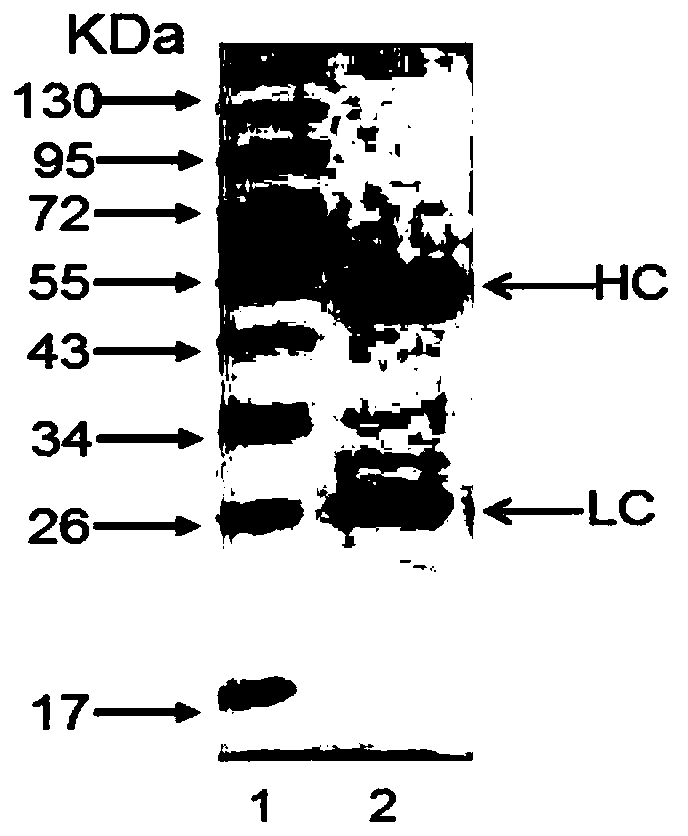 Immunohistochemical detection kit for human CD26 and clinical application thereof