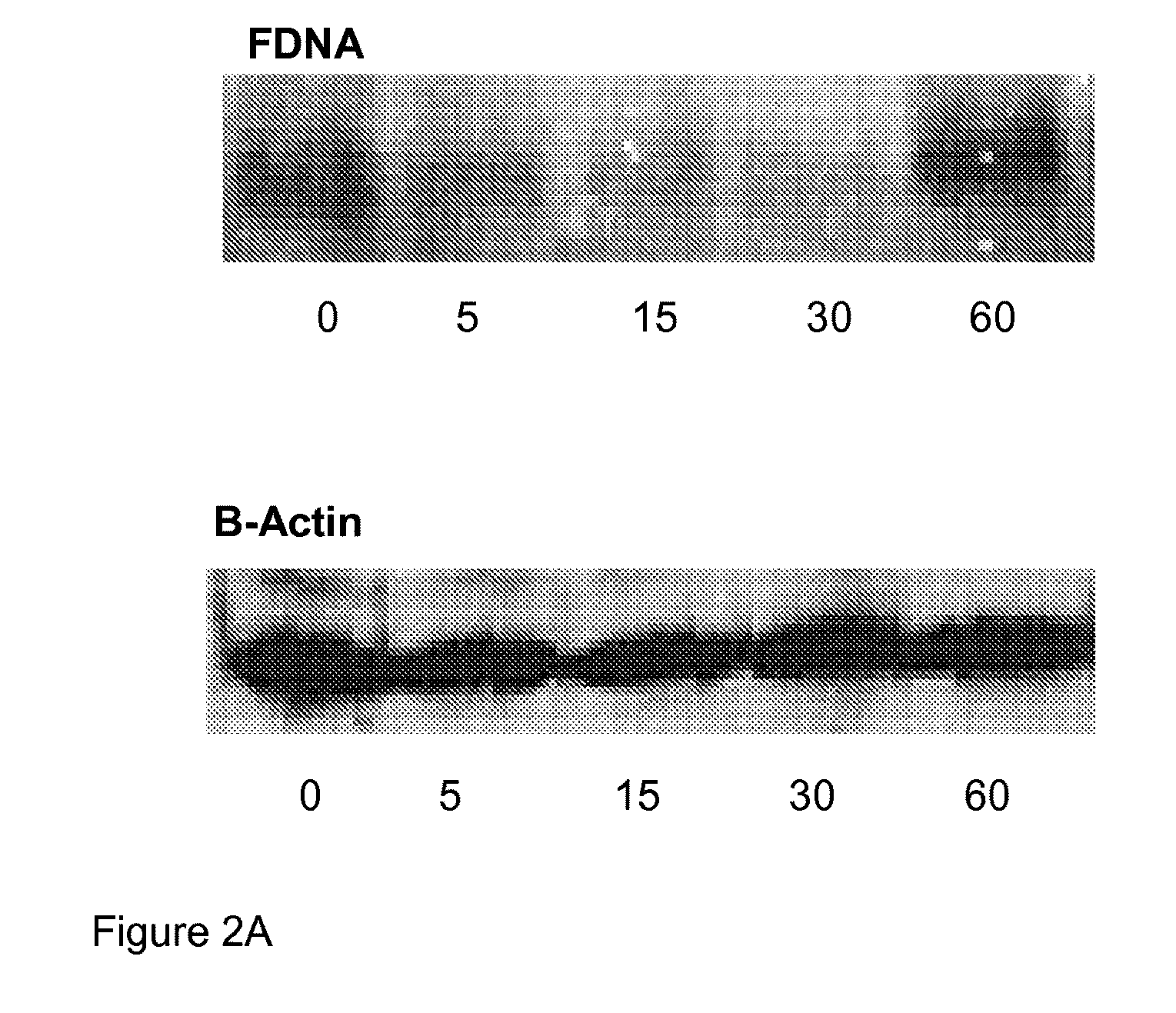 Composition and method for treatment of preterm labor