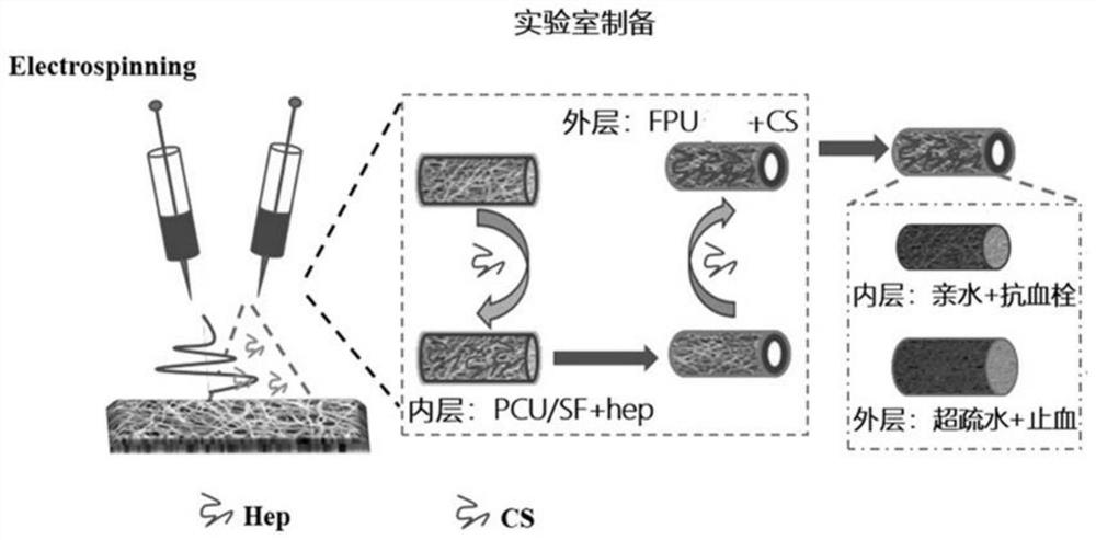 Double-layer artificial blood vessel and preparation method thereof