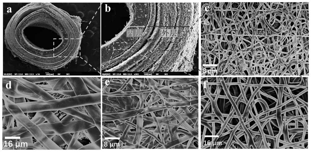 Double-layer artificial blood vessel and preparation method thereof