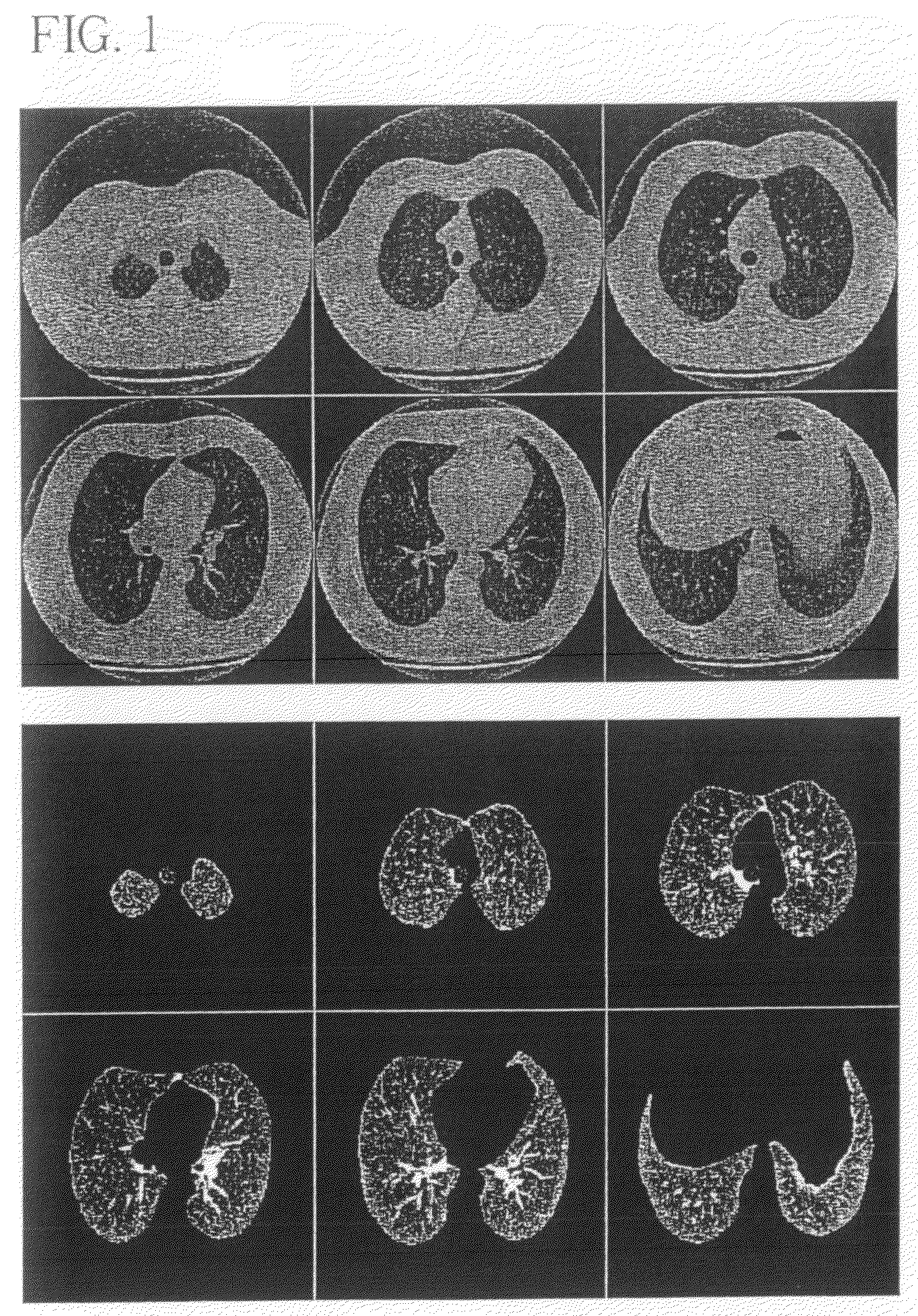 System, method and apparatus for small pulmonary nodule computer aided diagnosis from computed tomography scans