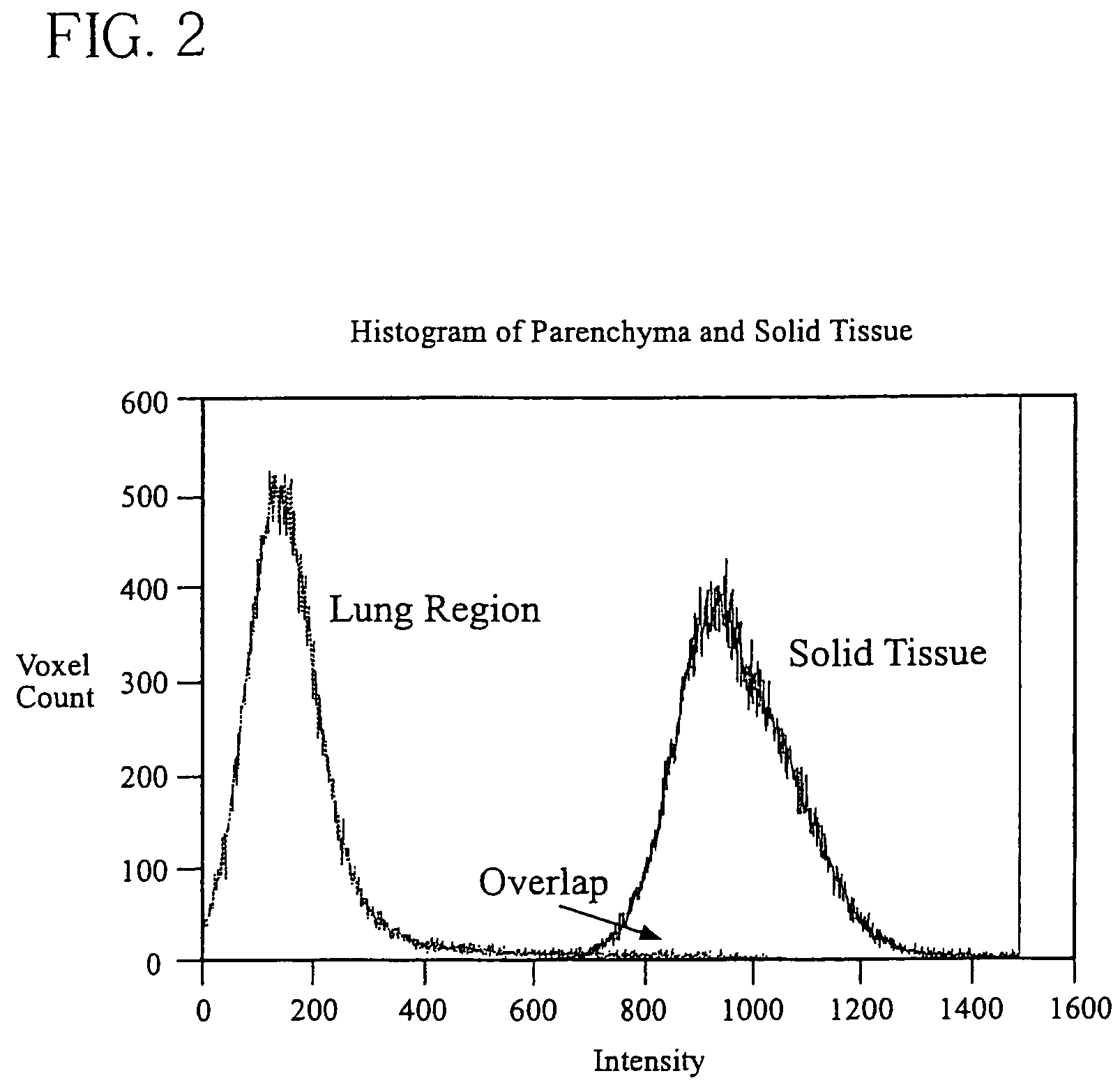 System, method and apparatus for small pulmonary nodule computer aided diagnosis from computed tomography scans