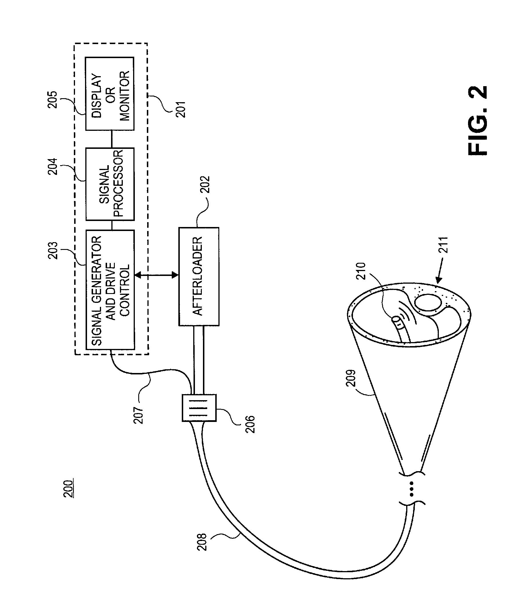 Method and apparatus for rupturing a vulnerable plaque