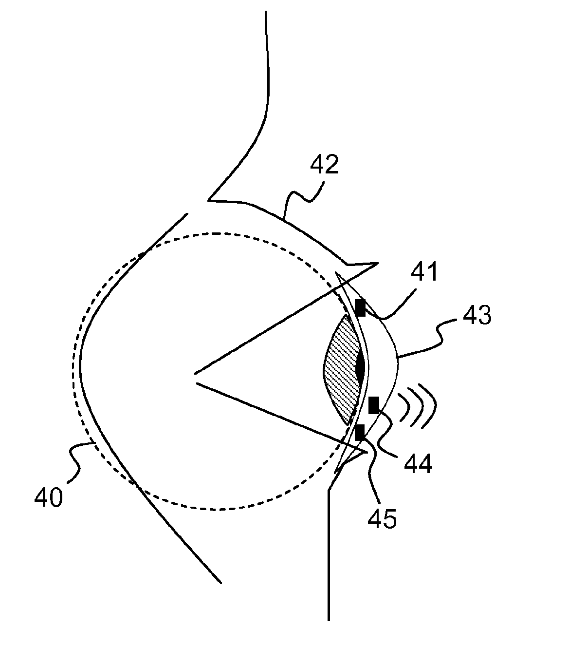Electronically controlled focusing ophthalmic device