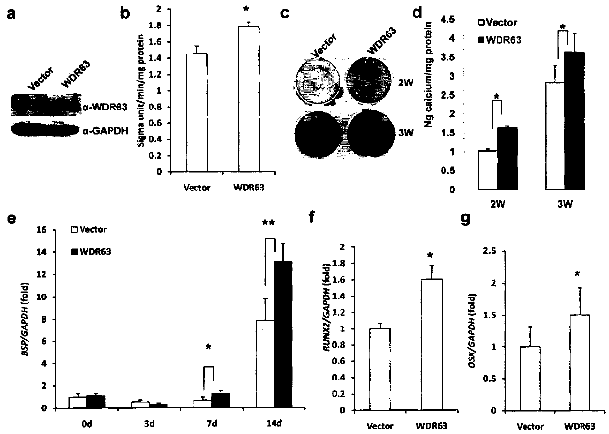 Regulation method of wdr63 gene in osteogenic and odontogenic differentiation of mesenchymal stem cells