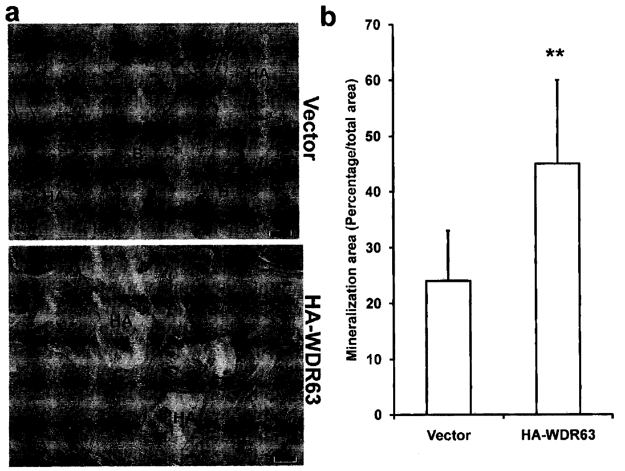 Regulation method of wdr63 gene in osteogenic and odontogenic differentiation of mesenchymal stem cells