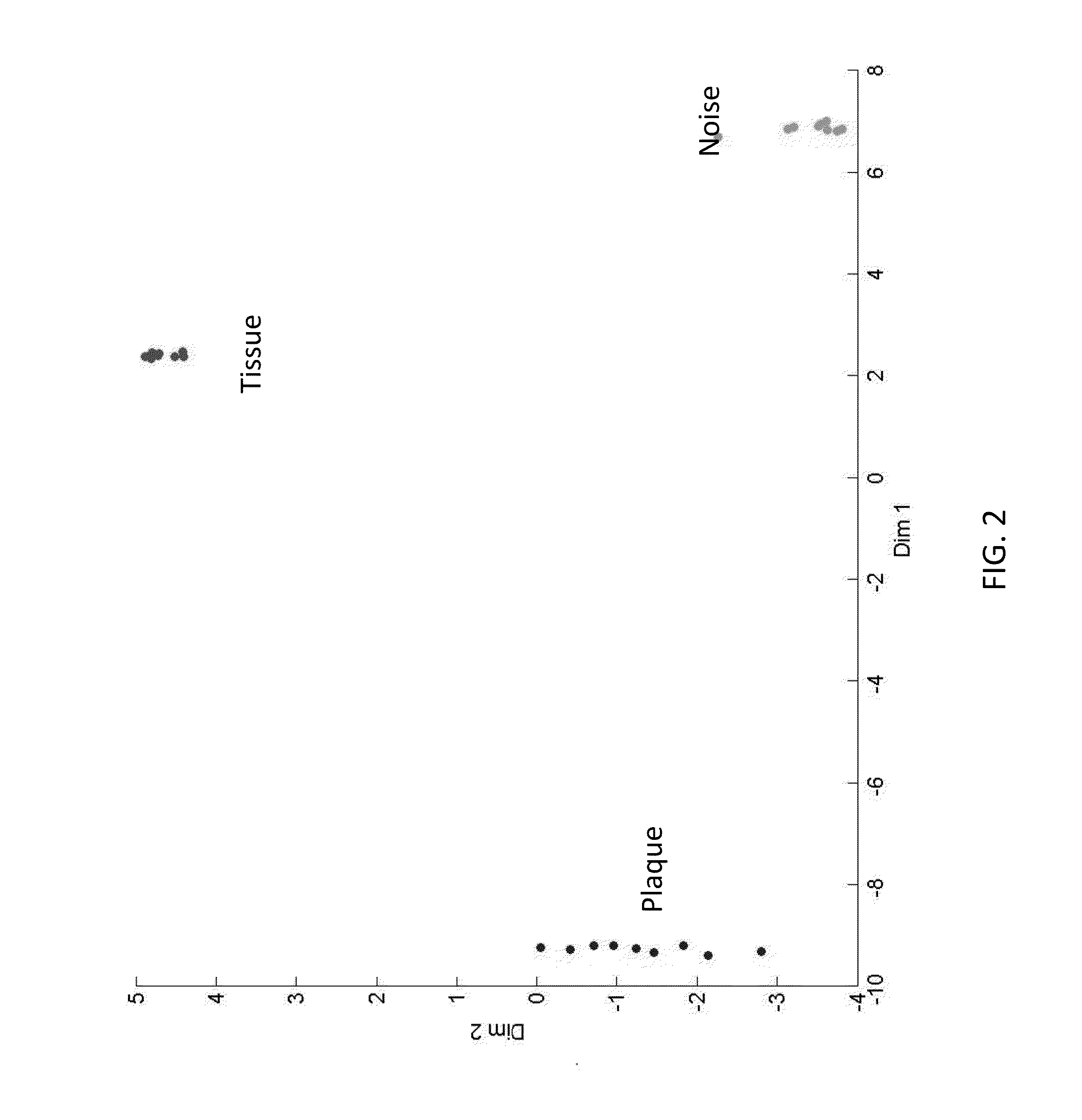 Method and system of characterization of carotid plaque