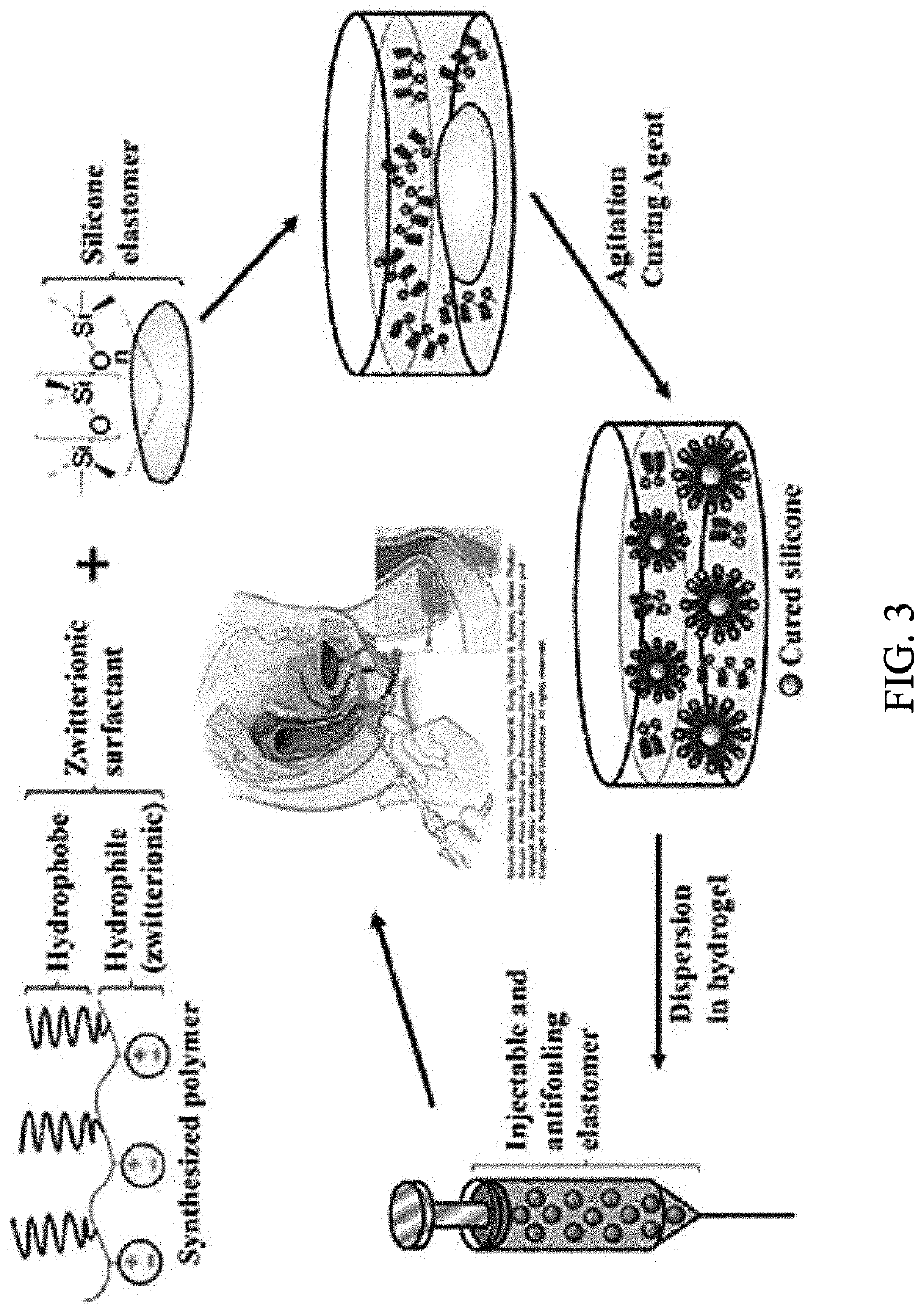 In vivo bulking agent, injection comprising same, and preparation method therefor