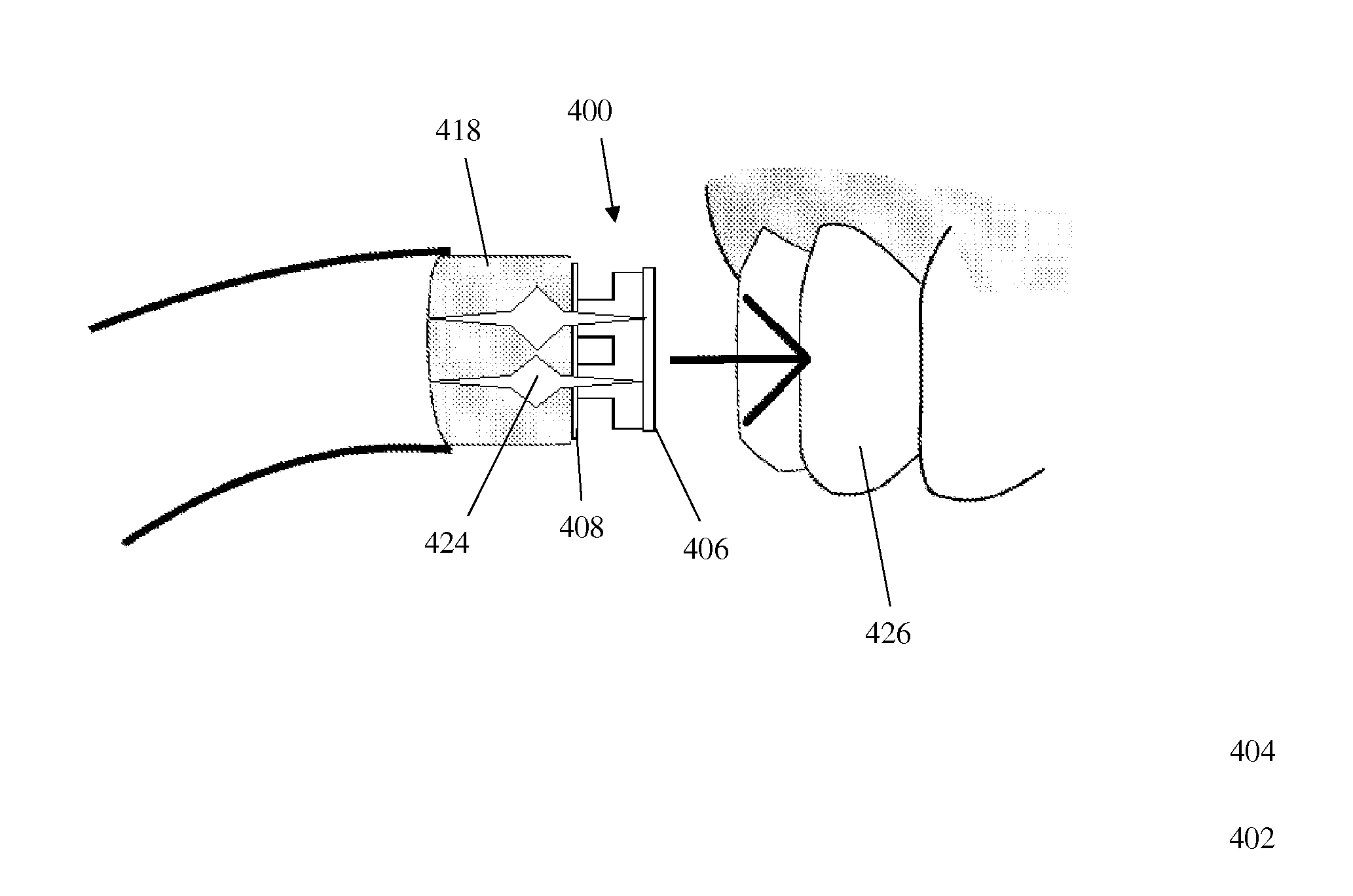 Hot melt dental materials and devices and methods for using the same