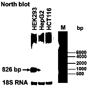Long-chain non-coding RNA MYC-AS1 expression Northern blot detection primer and kit