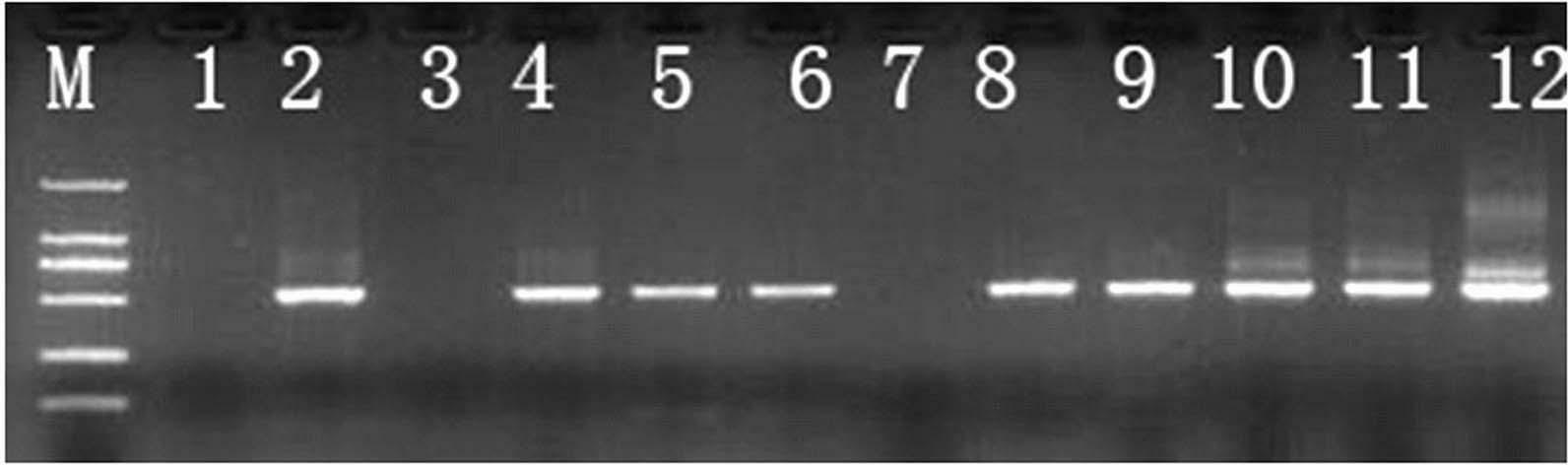 Sugarcane smut bacteria nest type polymerase chain reaction (PCR) quick detection method