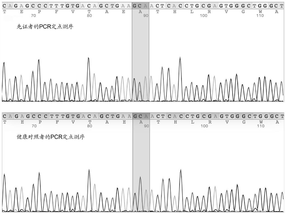 Screening kit for malignant arrhythmia, establishment method and application of animal model