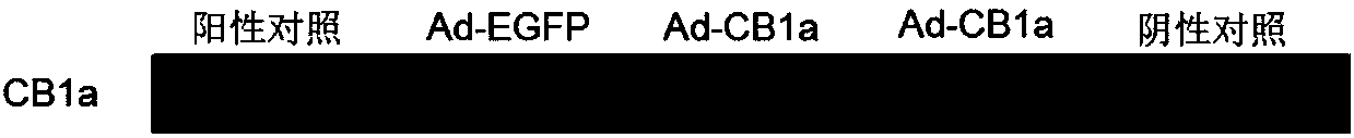 Recombinant adenovirus expressing anticancer peptide CB1a as well as construction method and application thereof