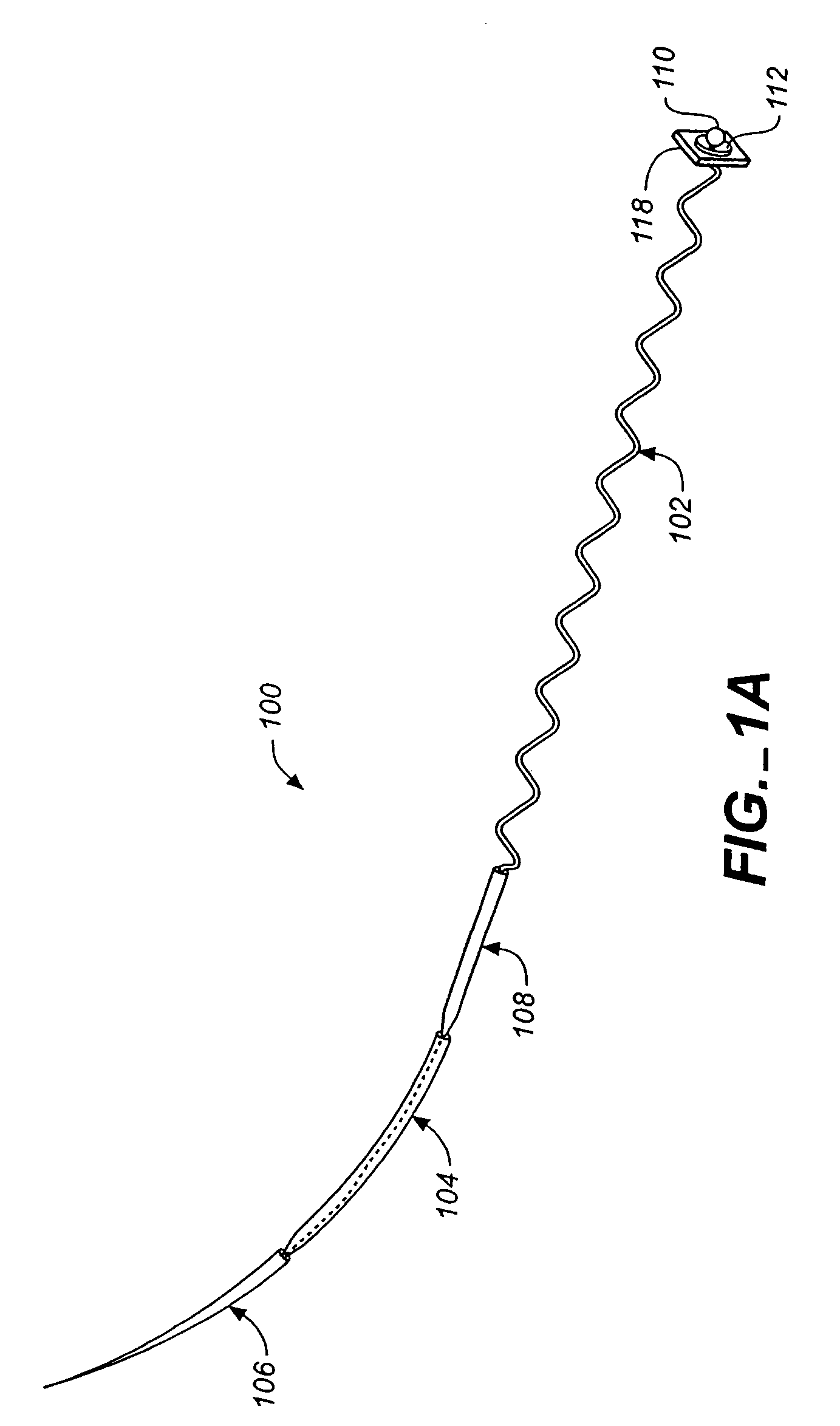 Annuloplasty apparatus and methods