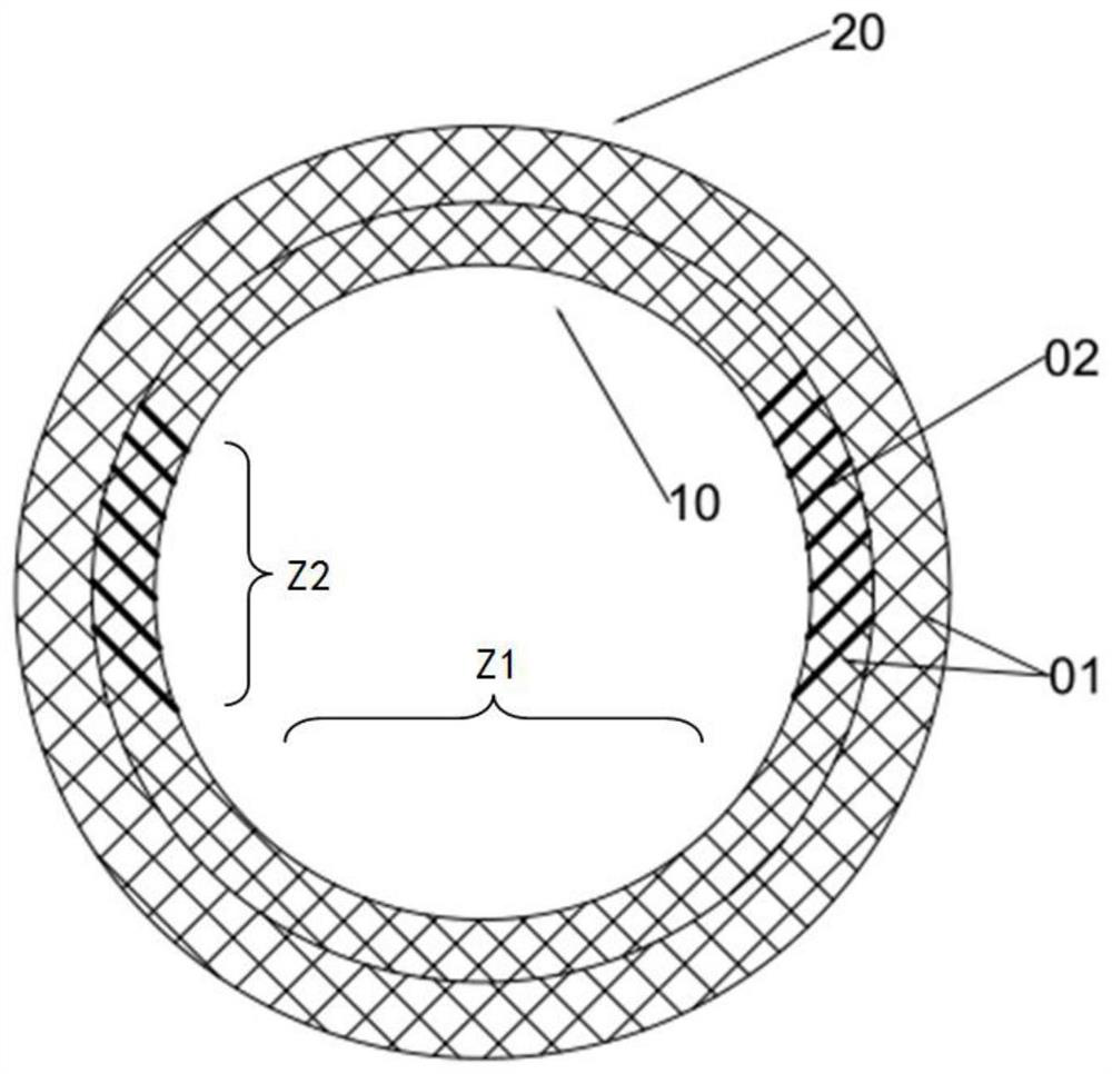 Medical stent for digestive system and manufacturing method thereof