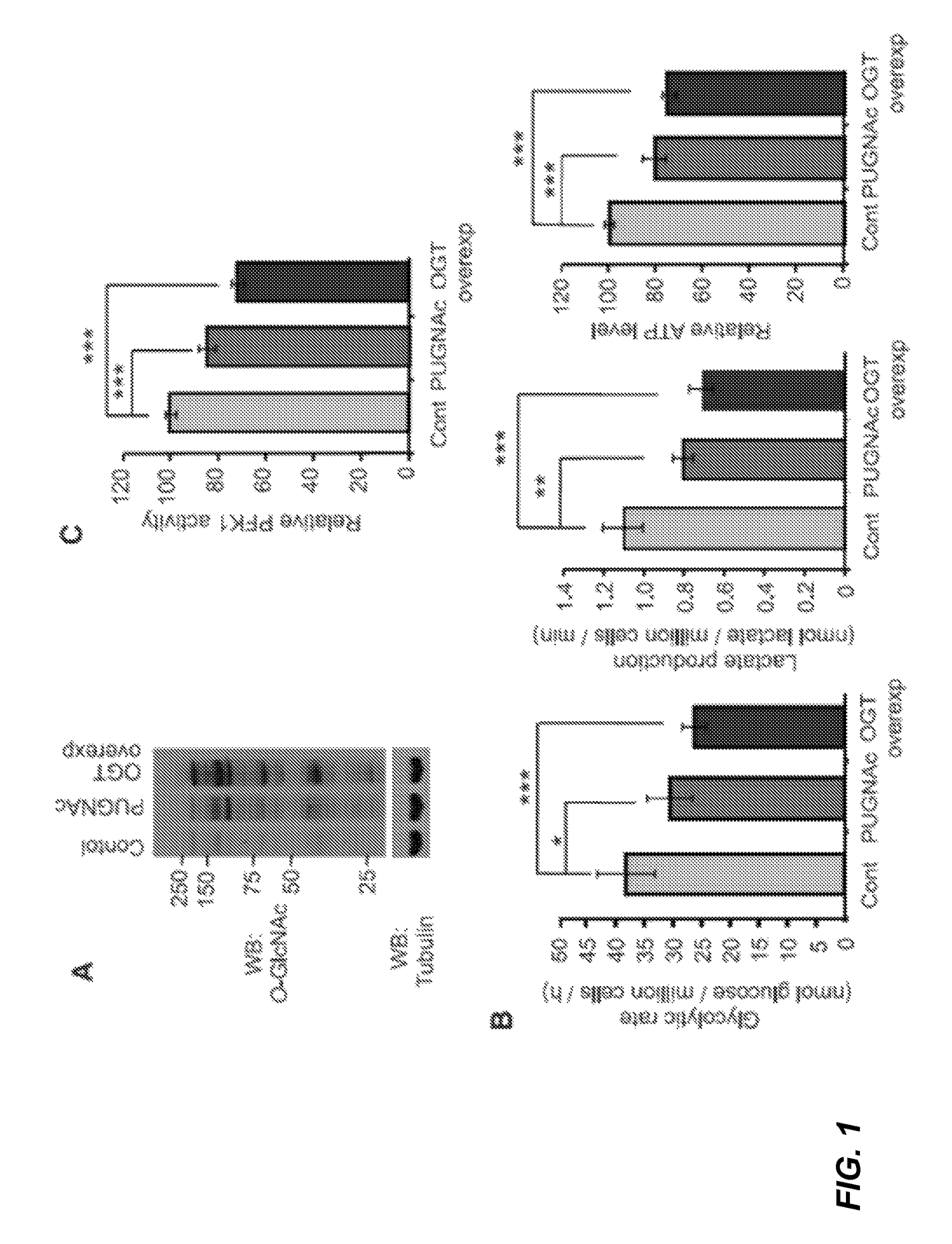 Targeting phosphofructokinase and its glycosylation form for cancer