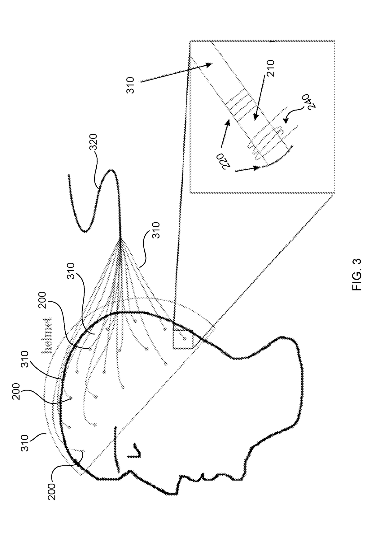 A magneto-encephalography device