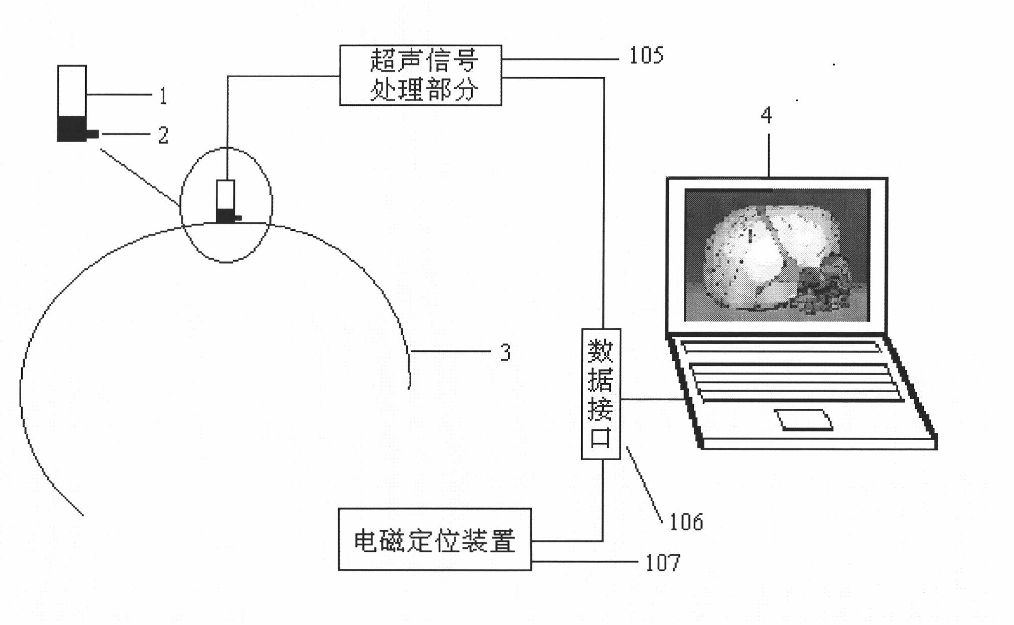 Quantitative measuring and analyzing system for development condition of baby skull