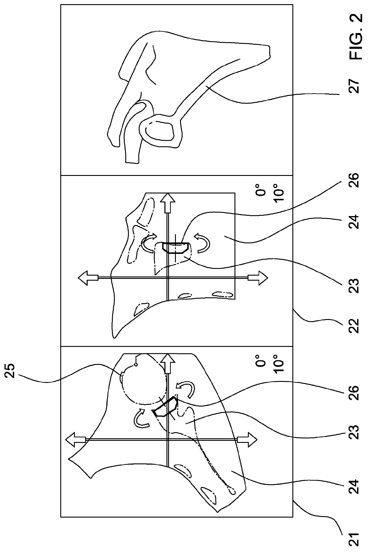 Method for automatically identifying the contours of a predefined bone, derived methods and corresponding computer program products