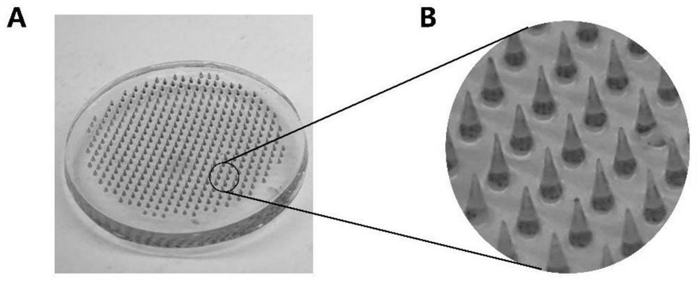 Oxidase-loaded microneedle for promoting wound healing of diabetic patient and preparation method of oxidase-loaded microneedle
