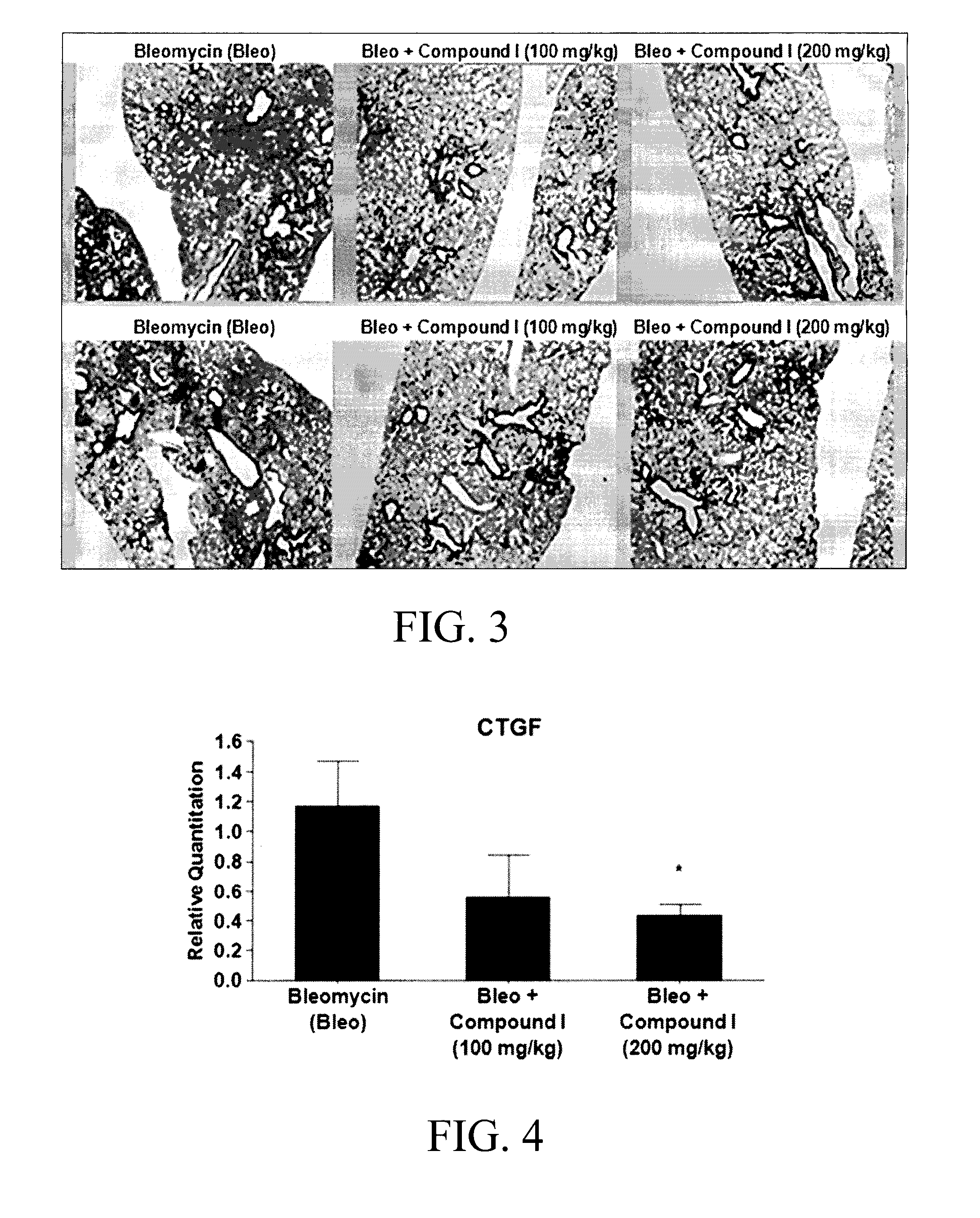 Substituted aromatic compounds for the treatment of pulmonary fibrosis, liver fibrosis,skin fibrosis and cardiac fibrosis