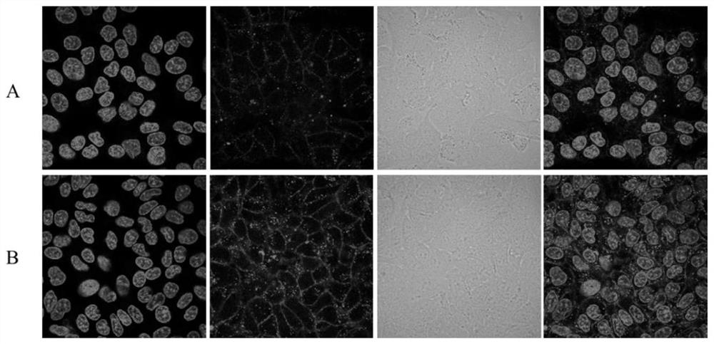 n-Azidoacetyl-d-mannosamine derivatives, preparation method thereof and application in detection of esterase