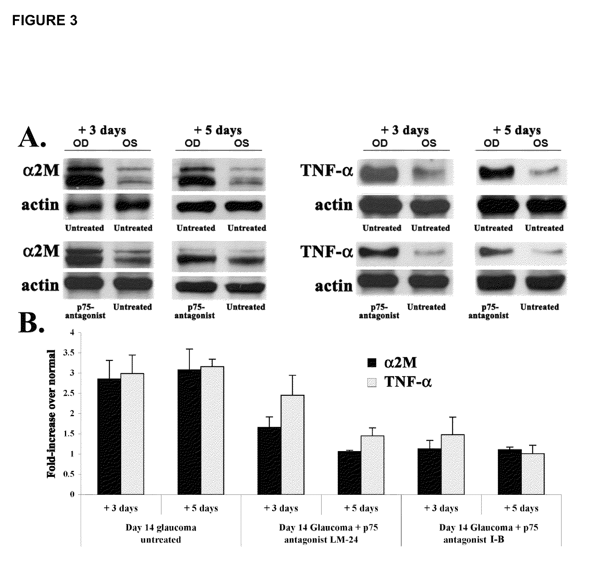 Inhibitors of p75 receptor and their uses