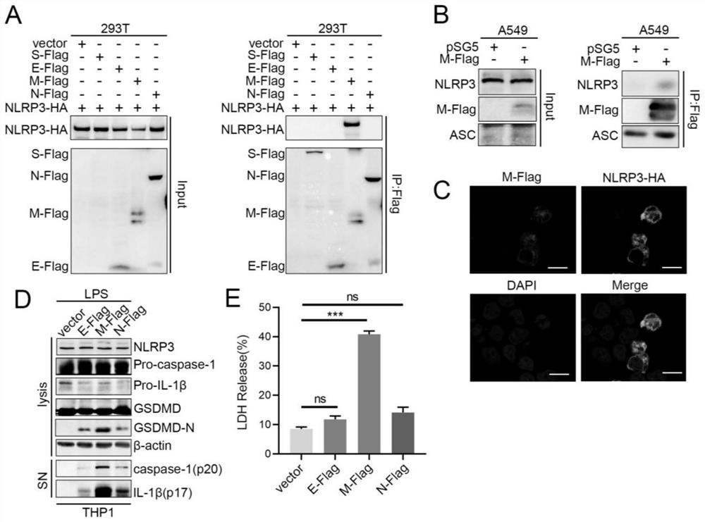 Application of intervening in NLRP3 inflammasome in preparation of medicine for treating novel coronavirus pneumonia