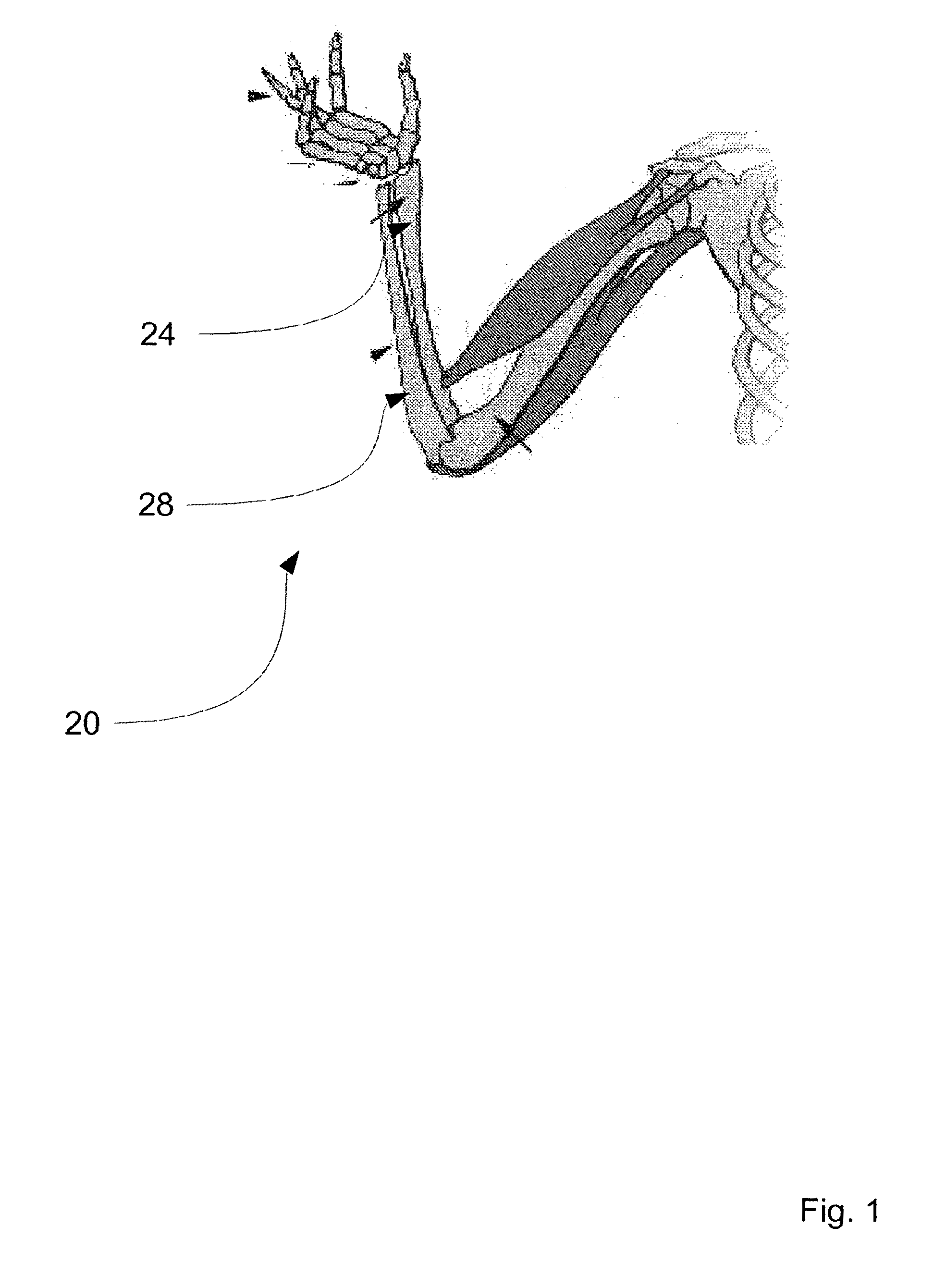 Method and kit for intra osseous navigation and augmentation of bone