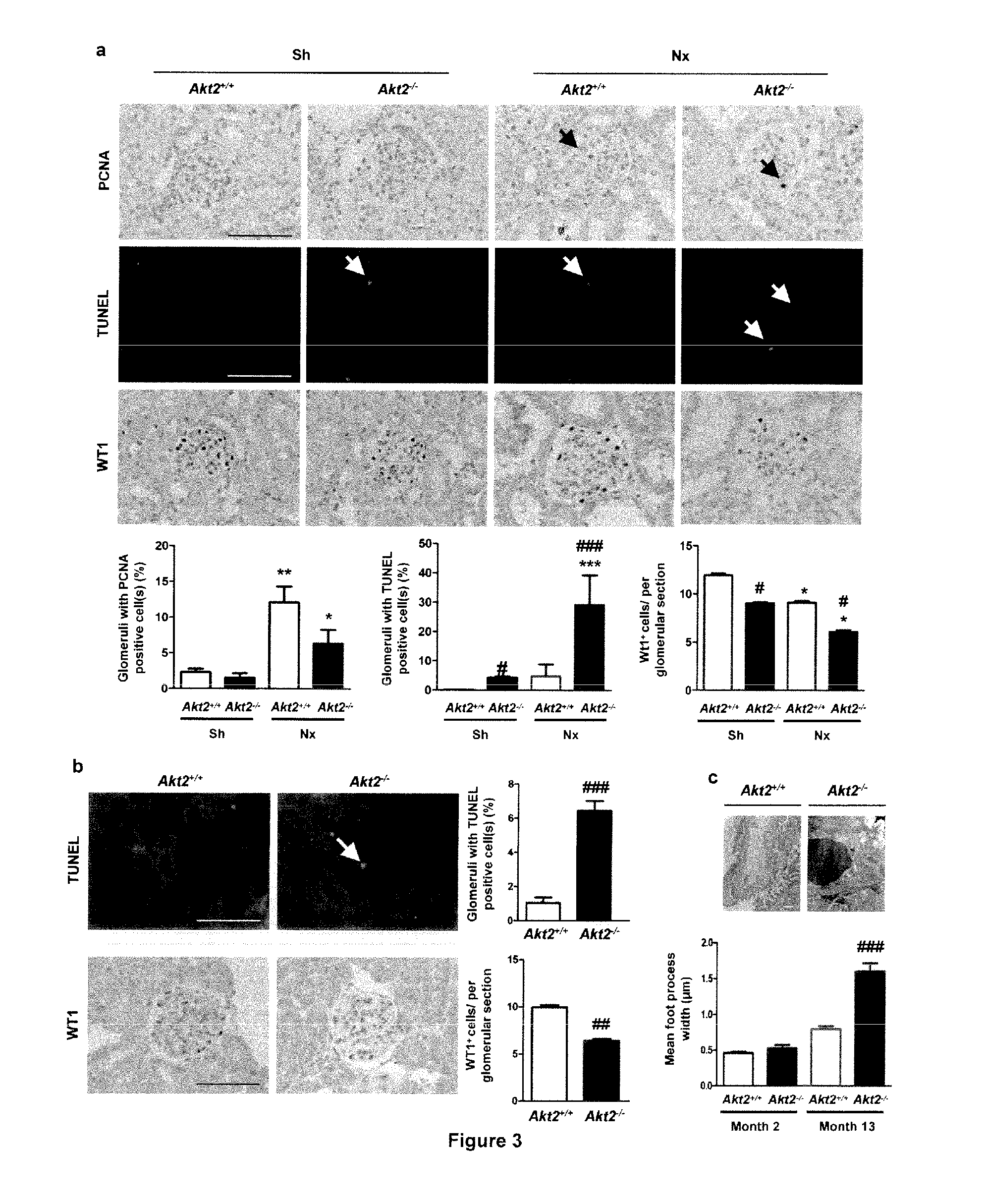 Biomarkers of renal disorders