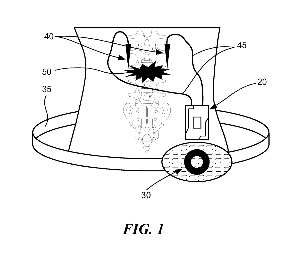 Self-Powered Bone Growth Stimulator