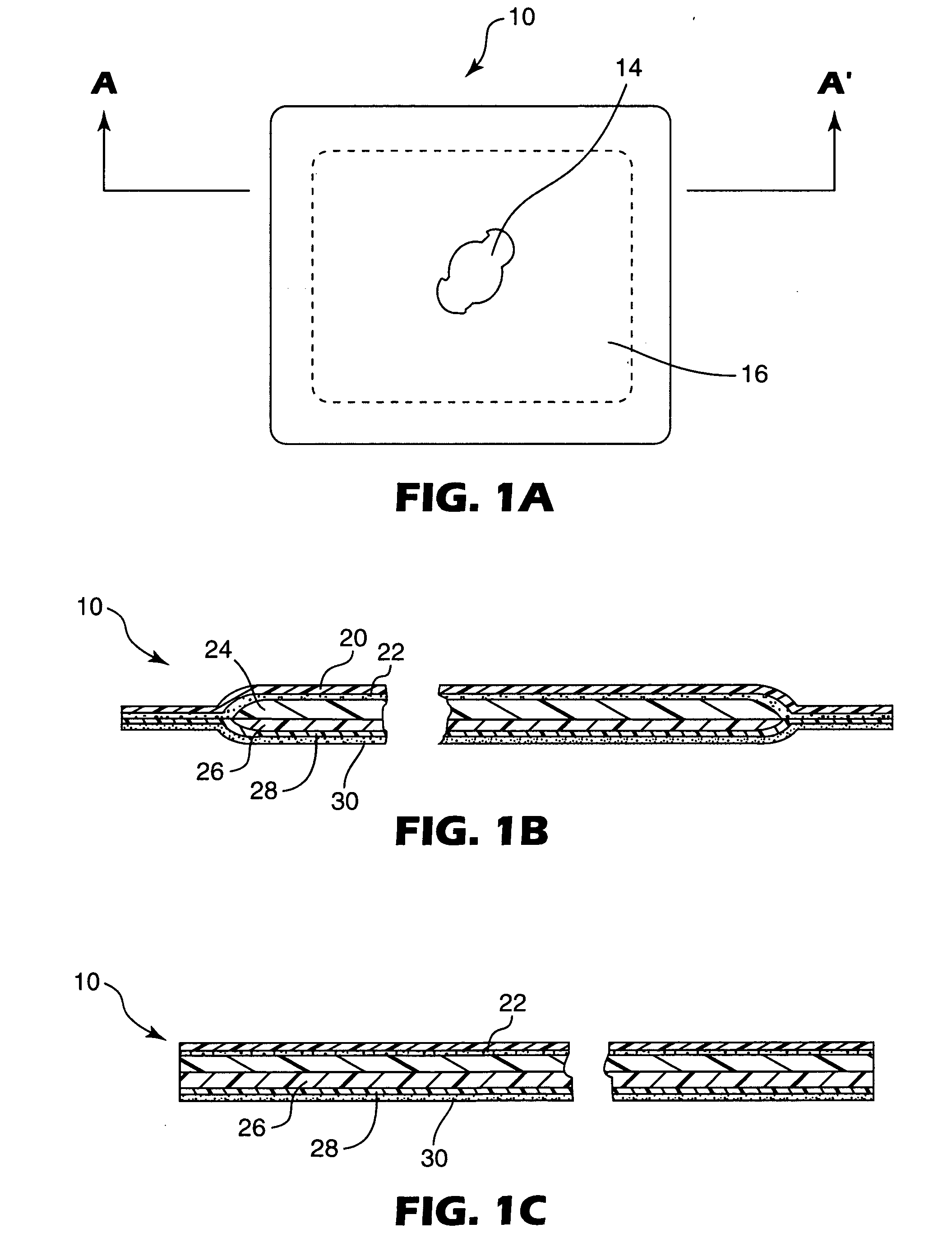 Multi-layer absorbent wound dressing