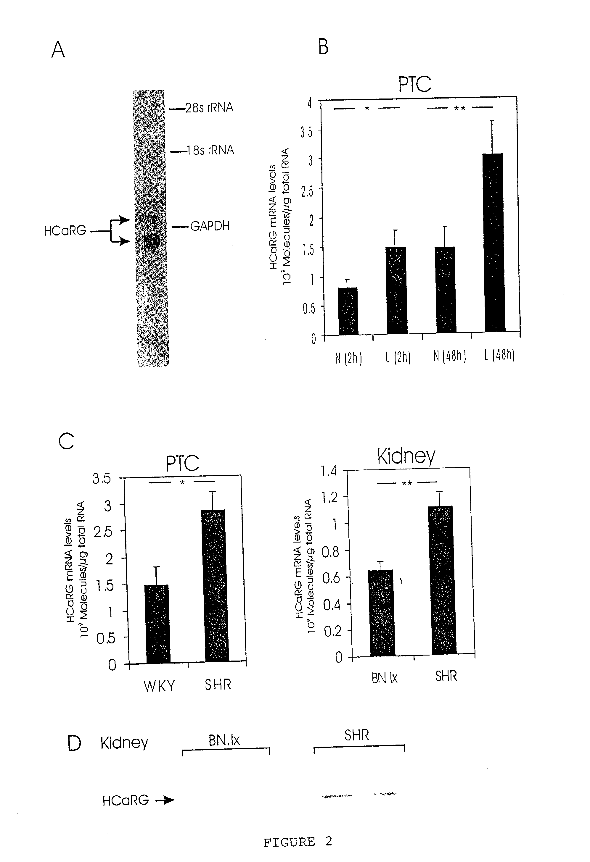 HCaRG, A Novel Calcium-Regulated Gene