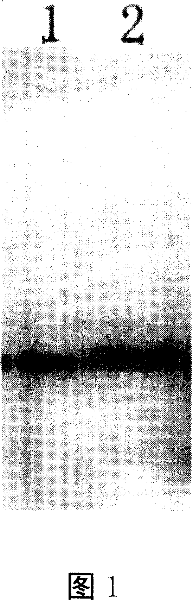 Method for expressing human insulin by using plant seed oil body