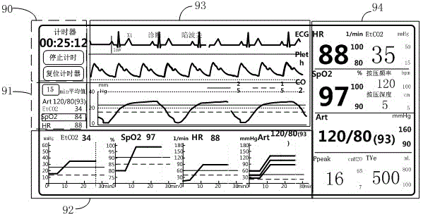 Method for displaying cardio pulmonary resuscitation (CPR) monitoring data, equipment for displaying CPR monitoring data, breathing machine and monitoring instrument