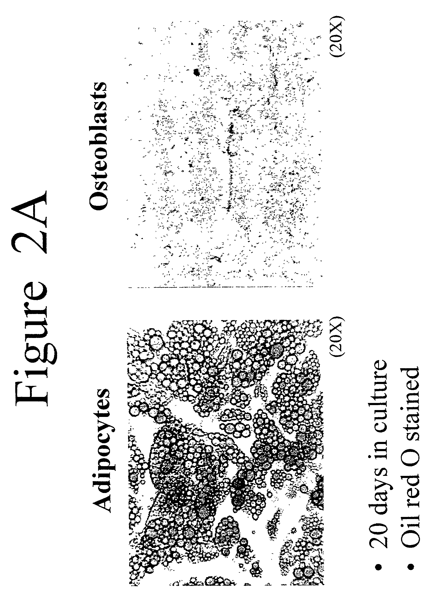 Differentiation of adipose stromal cells into osteoblasts and uses thereof