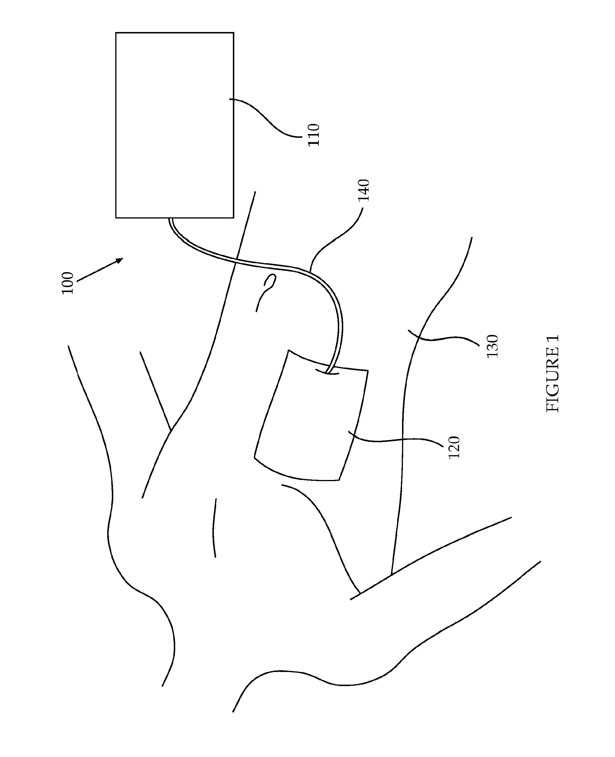 Devices And Methods For Detection Of Internal Bleeding And Hematoma