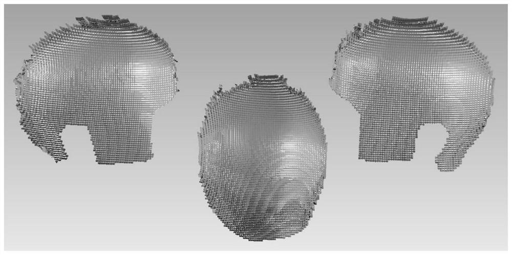 Quick three-dimensional human head measurement method based on digital speckle correlation