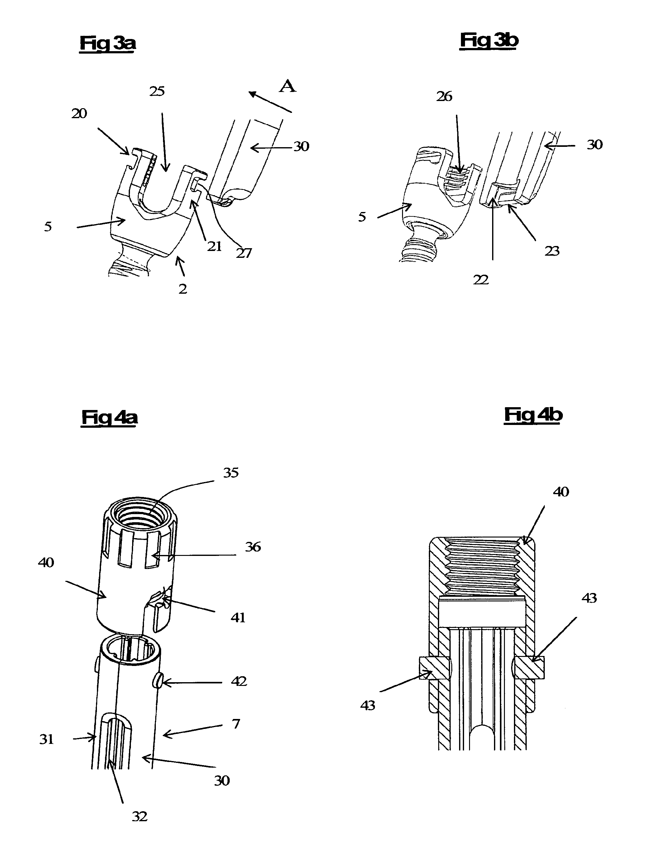 Device and method for spinal surgery