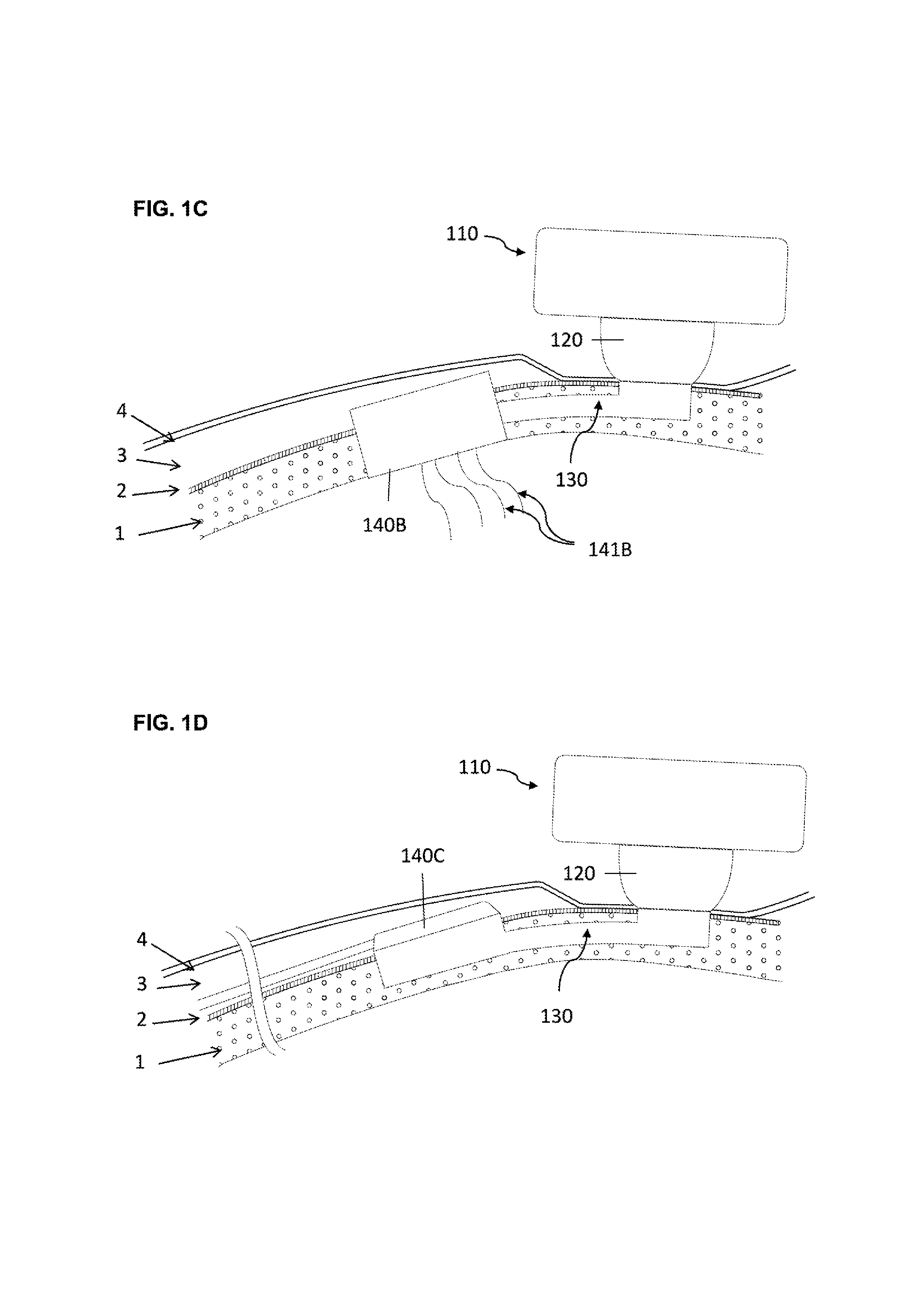 Percutaneous connection assembly for active medical devices