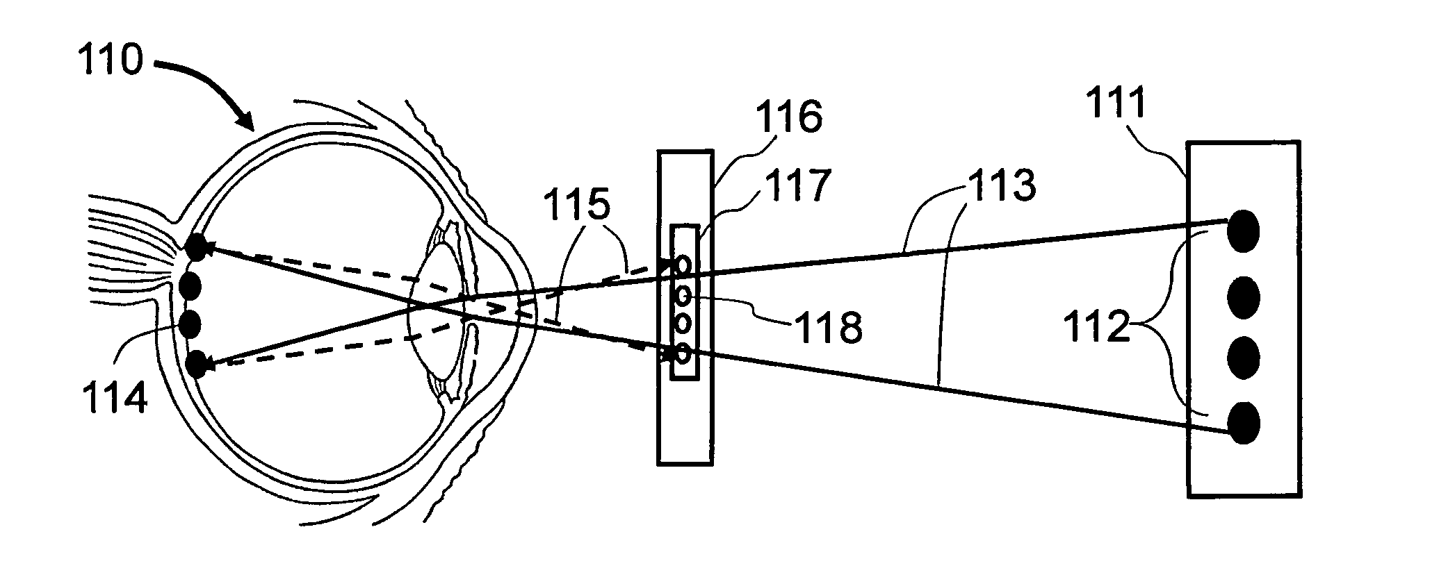 Method and apparatus to produce re-focusable vision by direct retinal projection with mirror array