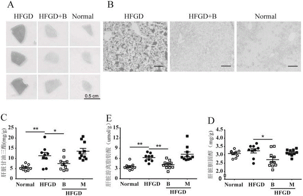 Drug for preventing and treating fatty liver and obesity and application thereof in drug preparation