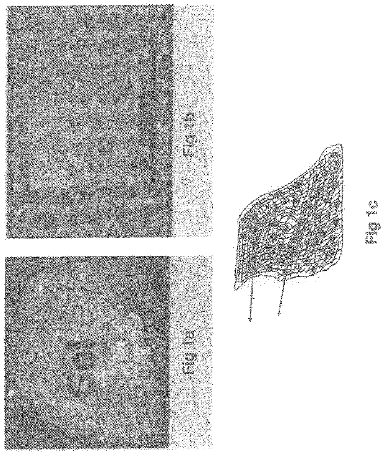 Treatment of ischemia and reperfusion using leptin antagonist