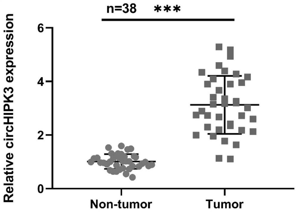 Application of hsa_circ_0000284 in preparation of neuroblastoma prognostic preparation