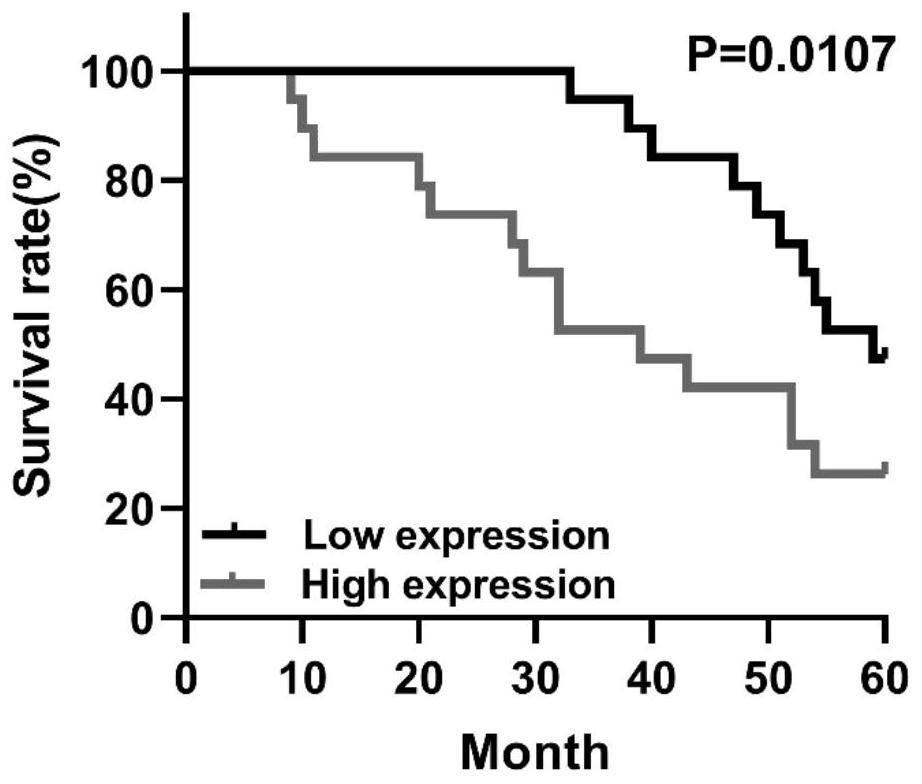 Application of hsa_circ_0000284 in preparation of neuroblastoma prognostic preparation