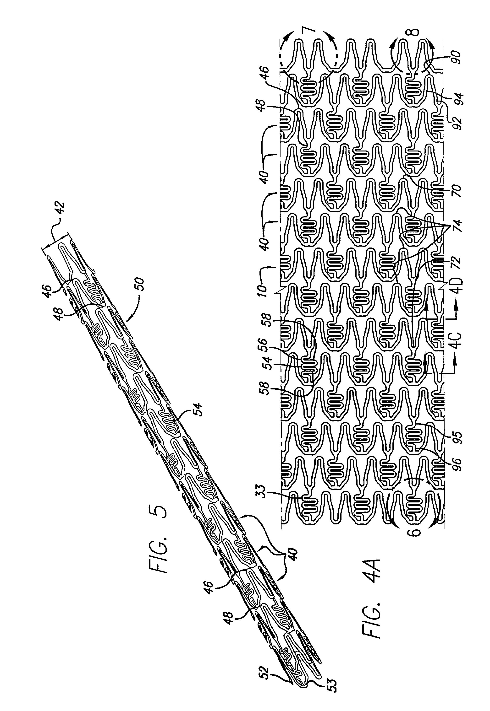 Hybrid stent and method of making