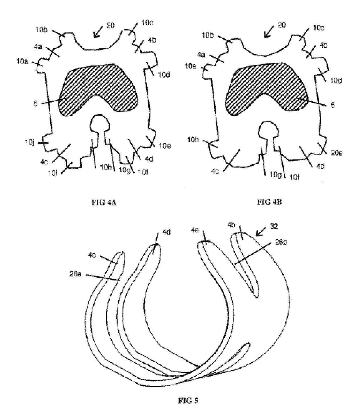 Resilient knee implant and methods