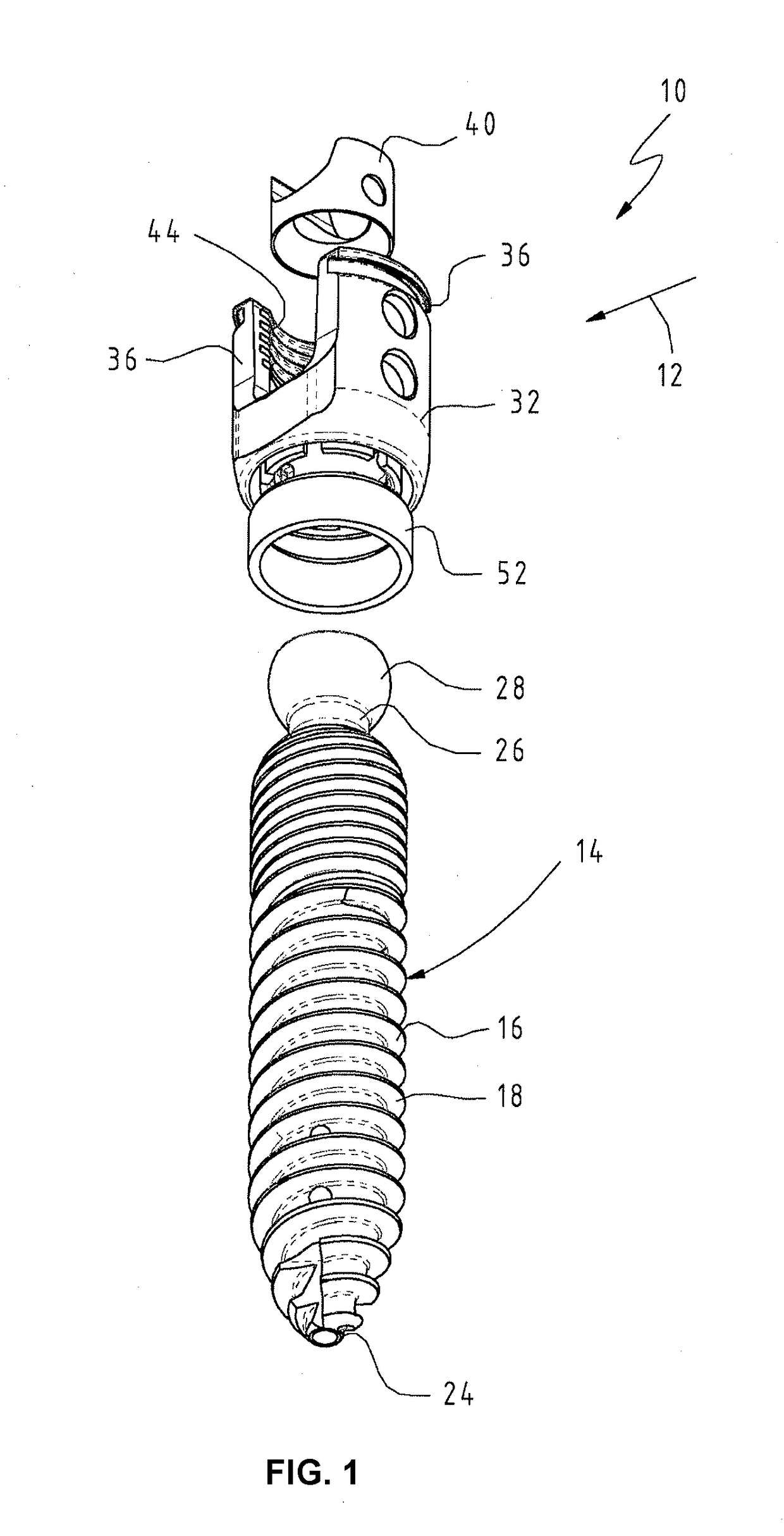 Osteosynthesis device