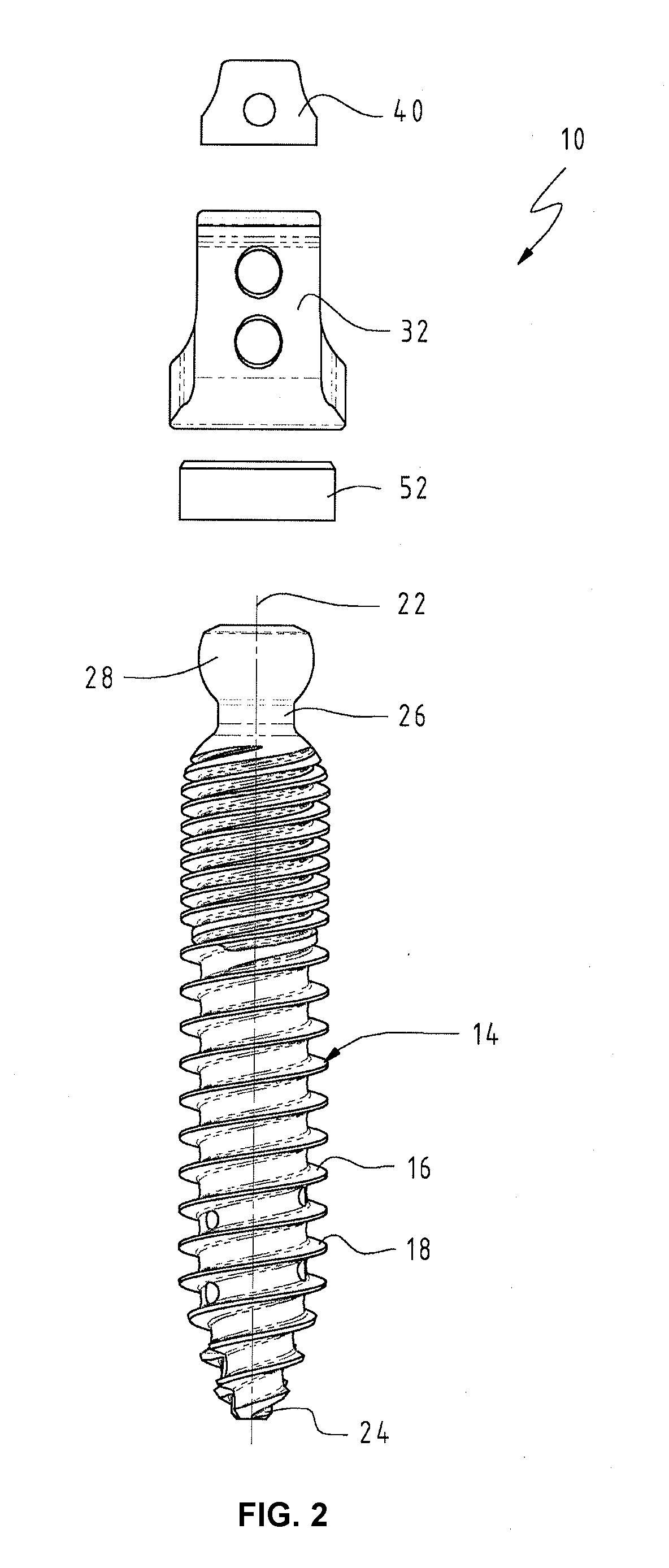 Osteosynthesis device