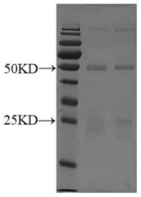 ENO2 monoclonal antibody 1C5 as well as preparation method and application thereof